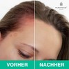 MAHNAZ® Bioactive Scalp Treatment, Soothing Intensive Care for Dry &