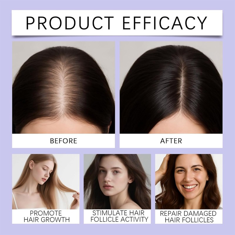 Sérum Congzikji para crecimiento del cabello con cepillo integrado –