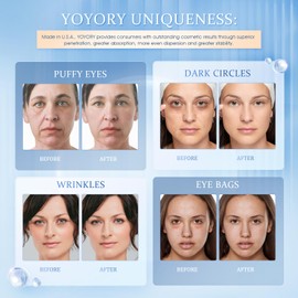 YOYORY Under Eye Patches Masks - for Dark Circles, Puffy Eyes, Fine Lines, Wrinkles, Eye Bags Treatment with Collagen and Hyaluronic Acid, Moisturizing and Hydrating (60 Pcs)