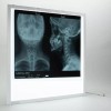 MED&LED Negatoscopio Led 5500 Lumen Para Tomografia Nueva Generacion