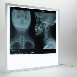 MED&LED Negatoscopio Led 5500 Lumen Para Tomografia Nueva Generacion