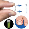 6 in 1 set Ingrown Toe Nail Fixer Pedicure Toenail