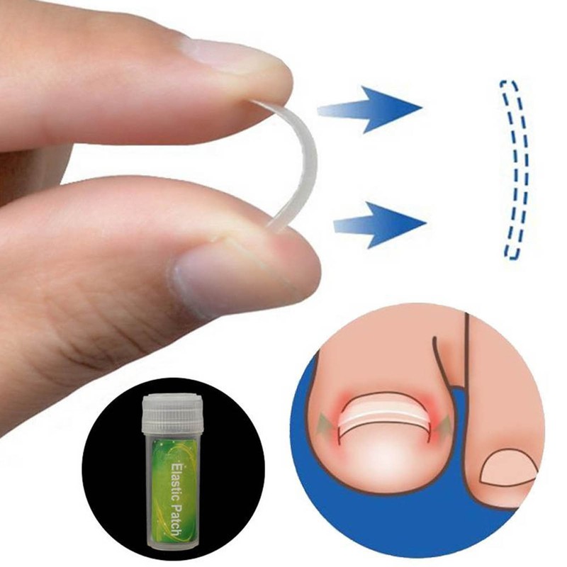 6 in 1 set Ingrown Toe Nail Fixer Pedicure Toenail