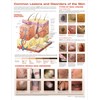 The Skin and Common Disorders Anatomical Chart