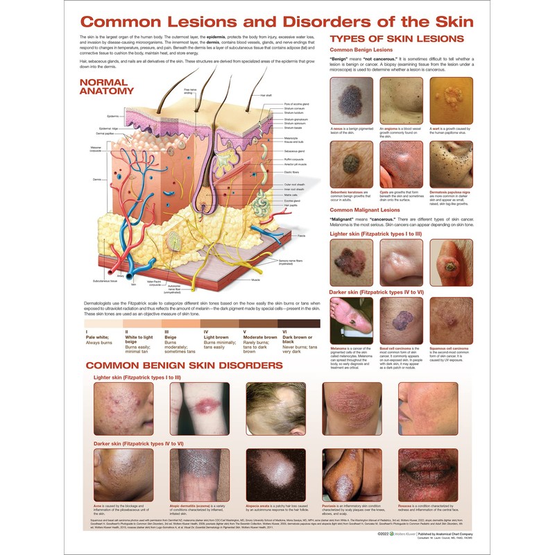 The Skin and Common Disorders Anatomical Chart