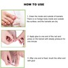 10pcs Toenail Correction Strips Brace Elastic Change Growth Direction Ingrown