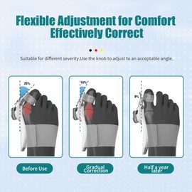 Hallux Valgus Correction Set for Men and Women, Bunion Corrector for Large Toes, Hallux Valgus Splints, Adjustable Button Splints, 1 x Toe Separator, 2 x Mounting Brackets for Toes, 1 x
