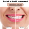 Small Orthodontic Elastic Bands - 5PCS/Pack, for Teeth Braces, Dental,
