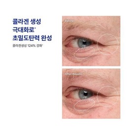 [August All-Young Pick] IOPE Retinol Super Bounce Serum 30ml Limited Edition (+20ml + Sun Ampoule 20ml) / 아이오페 레티놀 슈퍼 바운스 세럼 30ml 한정기획 (+20ml+선앰플 20ml)