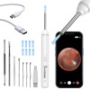 Ear Wax Removal Kit: 1920P HD Camera & 8-Pc Ear