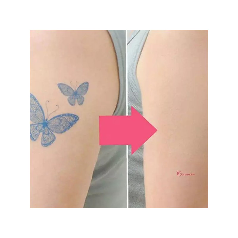 Cover Tattoo 커버타투 시트 가리기3타입 흉터 멍 멍가리기3타입efg693 [1-1.일반사이즈(10매)-핑크내츄럴] Cover