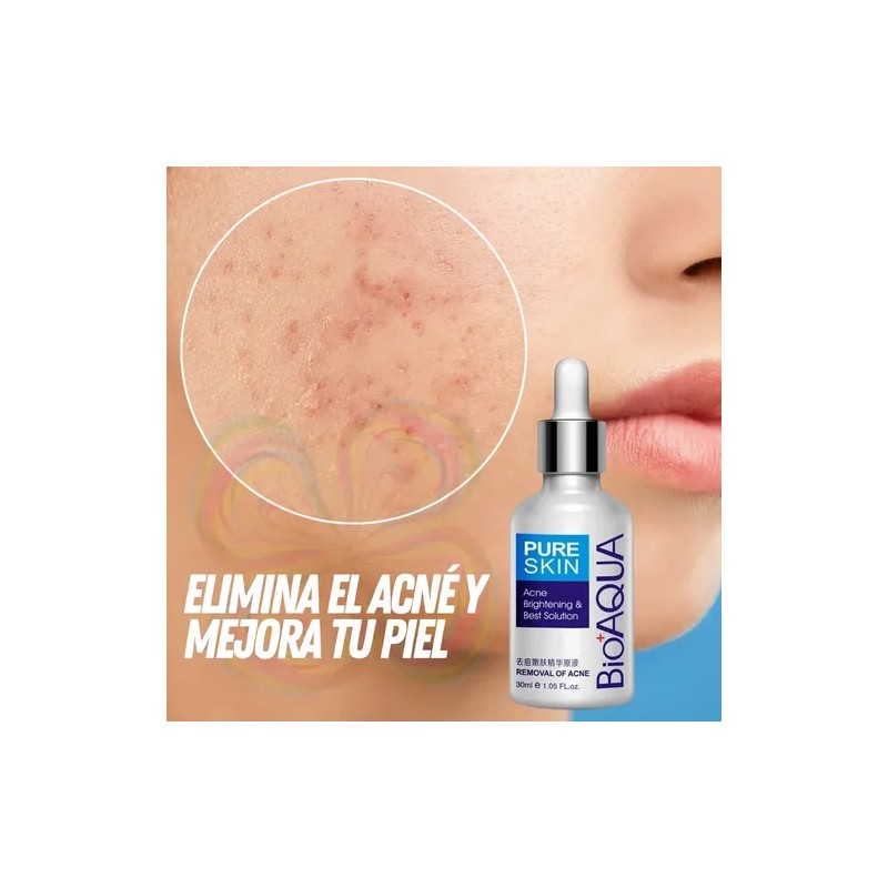 Crema Serum Bioaqua Pure Skin Tratamiento Anti-acne Manchas