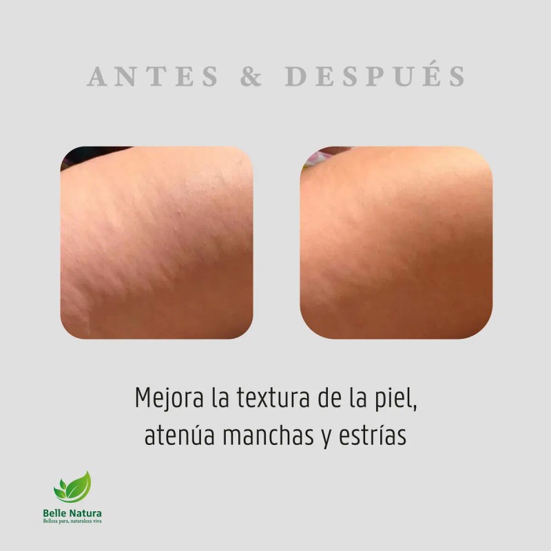 Crema De Baba De Caracol Con Filtro Solar Anti-manchas 1