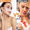 Nasal Bandage,2 Pcs Nose Bleed Stopper Elastic Nose Bandages Nose