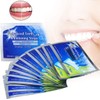 28pcs Teeth Whitening Strips, Professional Teeth Whitener Strips, No Sensitive
