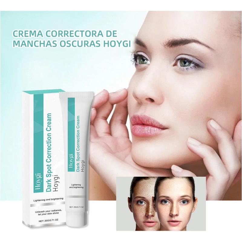 Ab La Crema Correctora De Manchas Aclara Las Manchas Oscuras