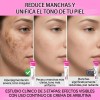 Crema Despigmentante, Hidratante E Iluminadora, 2 Unidades