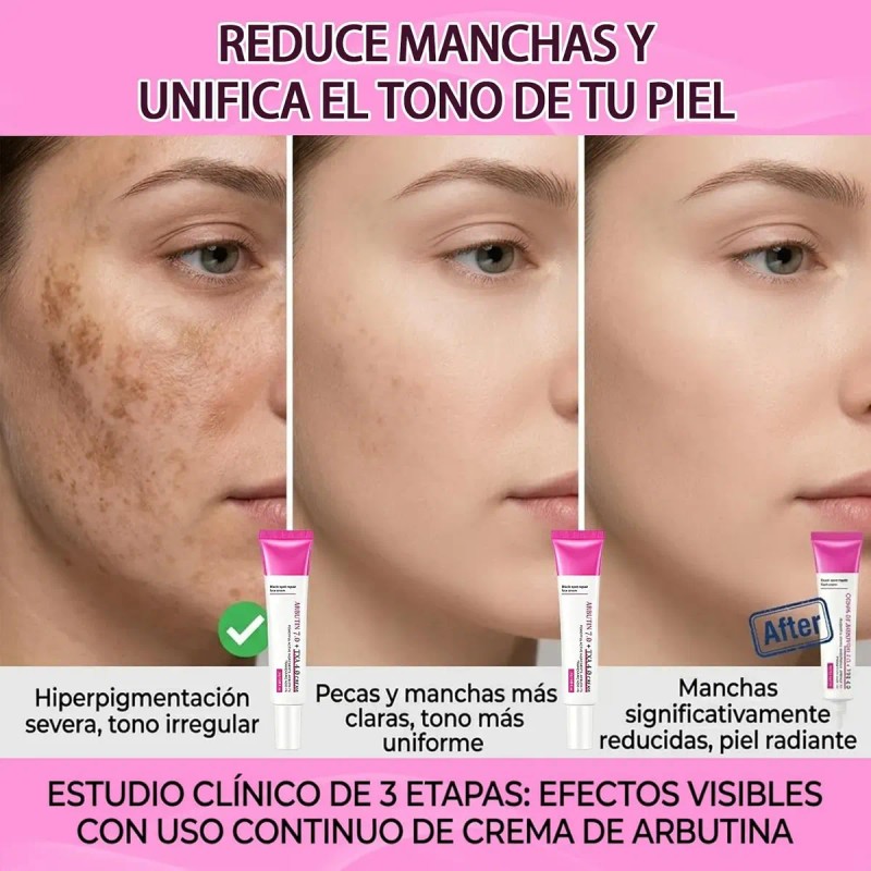 Crema Despigmentante, Hidratante E Iluminadora, 2 Unidades