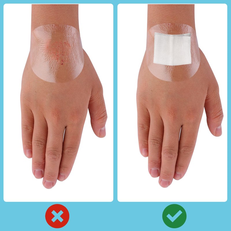 100Pcs Waterproof Bandaids, Adhesive Transparent Film Dressing Bandages