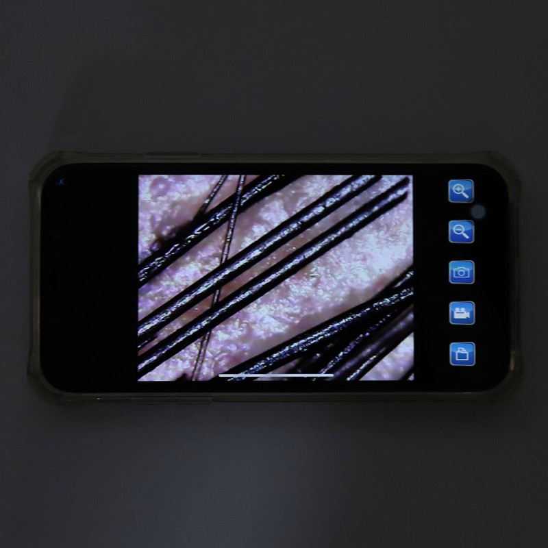 2MP Camera 100X Wifi Digital Microscope Skin Analyser Professional Magnification