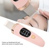 Face Skin Scrubber Vibration Face Peeling Machine Ultrasonic Exfoliating SkinCare