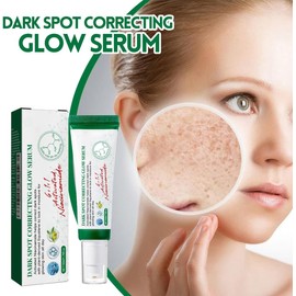 Suero Facial con Nicotinamida, Corrector de Manchas Oscuras, Elimina Pecas y Acné, Mejora la Melanina, Brillo para Rostro Opaco (3 PCS)