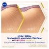 Sérum NIVEA Luminous 630 tratamiento avanzado anti estrías 100 ml