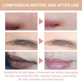 Facial Hair Removal Cream,Moisturizing Facial Hair Removal,Moisturizing Painless Hair Removal, De-lay Hair Growth,Gentle Upper Lip Hair Remover,Smooth Face Body Skin,Suitable for All Skin Types