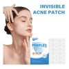 Parches Para Espinillas, Parches Para El Acné, Parches Hidro