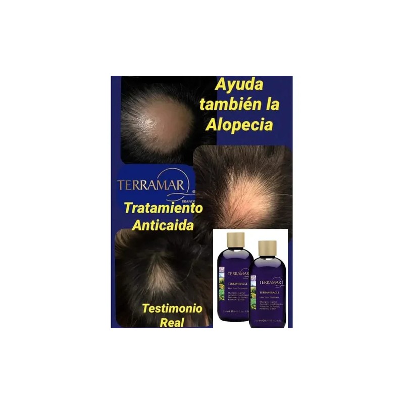 3 Shampoo Anticaida Para El Cabello Terramiracle Original