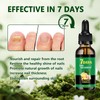 Nail FungusTreatment, Ginger Nail Growth Serum for Toenail and Fingernail,