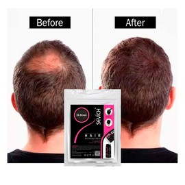 Sevich Micro Fibras Naturales 100 grs Disminuye la Calvicie (Café Medio)