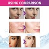 2 Piezas Crema de Urea que Decolora las Manchas, Crema