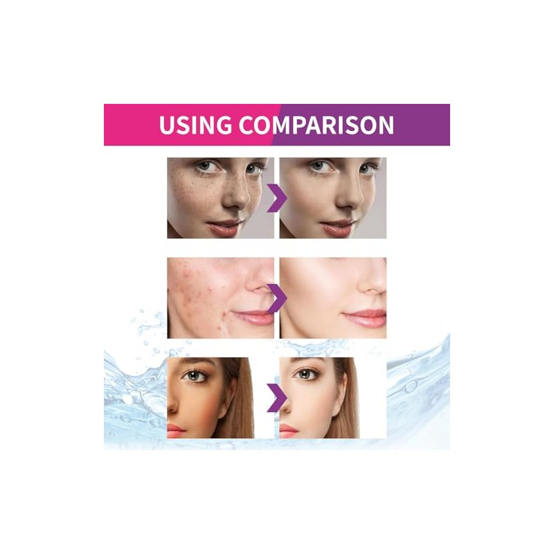 2 Piezas Crema de Urea que Decolora las Manchas, Crema