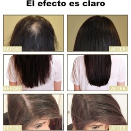 Aceite capilar natural de romero orgnico. Favorece el crecimiento del cabello, reduce la cada y protege la salud del cuero cabelludo (3pcs)           