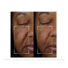 StriVectin NEW Strivectin Tighten & Lift Peptight Face Lift Serums