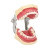 Periodontal Disease Teeth Resin Model Dental Demonstration Teeth Model for
