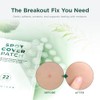 SKIN1004 Spot Cover Patch 22ea