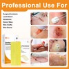 Carbou Medical Xeroform Petrolatum Dressing 5"x9", 25 Individual Pack, Non-Adherent