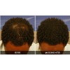Dr. Yates MD Keratin Fiber Hair Enhancer (Medium Brown)