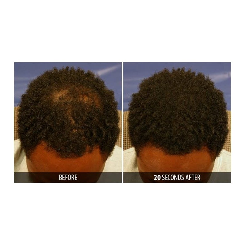 Dr. Yates MD Keratin Fiber Hair Enhancer (Medium Brown)