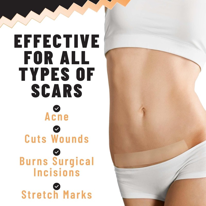 TOLEVITA Silicone Scar Patches – Silicone Gel Sheets for Scars,