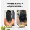 Aceite Puro Colágeno Elastina Reduce Y Evita Estrías Neutra