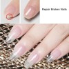 Nail Repair Protection Gel, 2025 New Nail Repair Kit For