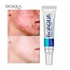 Bioaqua Acne Cream Cicatrices Poros Control De Grasa Full Tipo