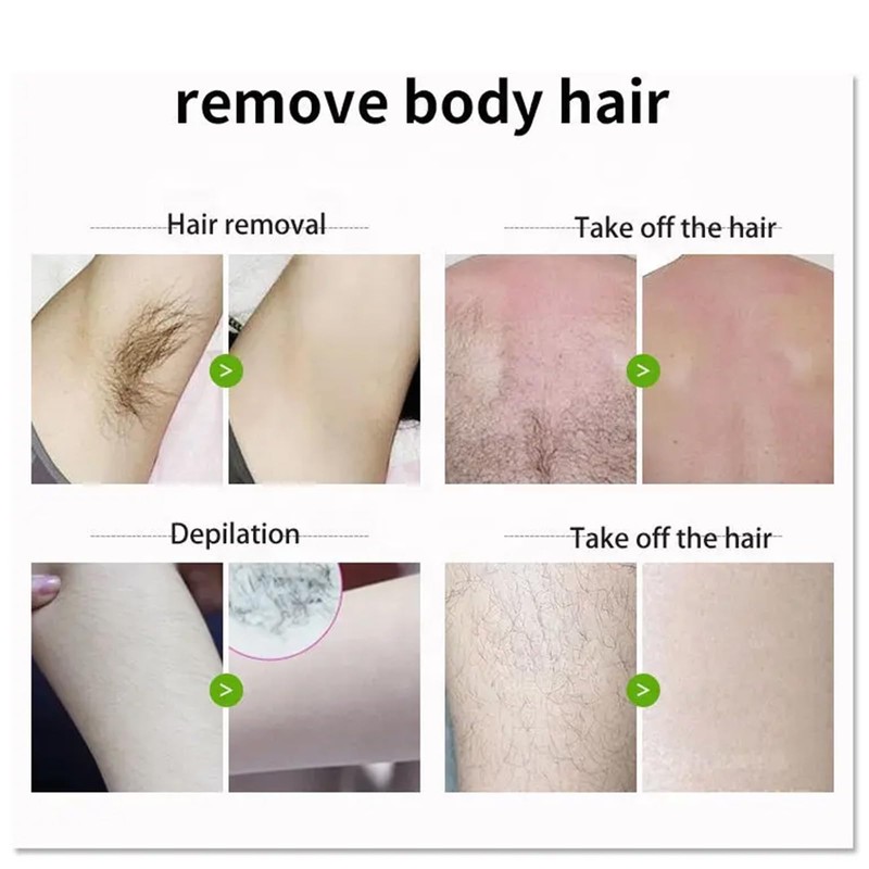 Haarentfernungscreme Körper Enthaarungscreme Sanfte Haarentfernungscreme Painless Hair Remover Cream Verbrennt