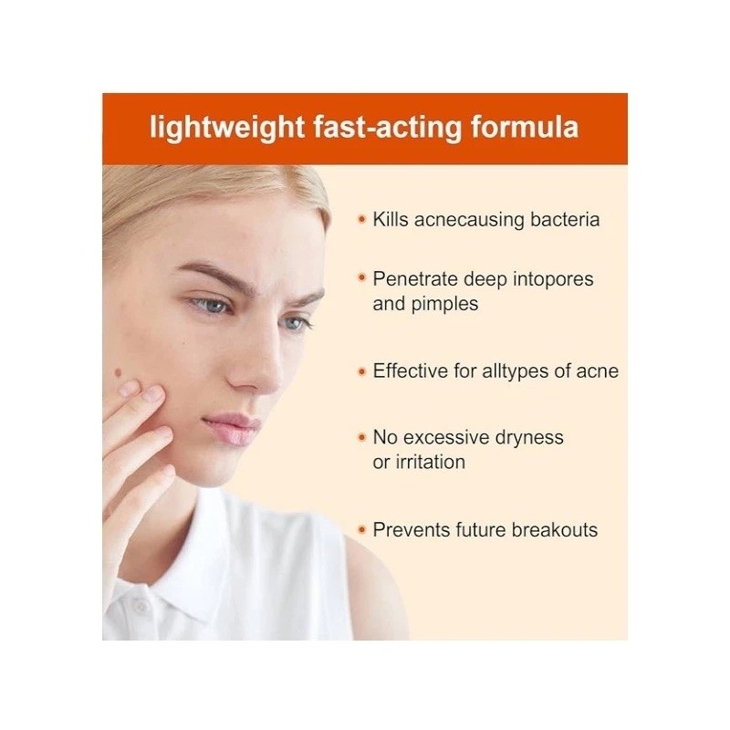 Tamoskiny Acne Face Blemish Pimple Cream Salicylic Cystic Breakout Treatment