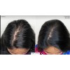 Locion Fortificante Para Caida Y Crecimiento Del Cabello