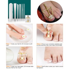 Ingrown Toenail Pedicure Knife Stainless Steel Set,Ingrown Toenail Corrector for Thick Ingrown Nail Callus Paronychia Corn (2)