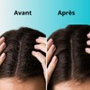 Iniya Anti-Dandruff Shampoo gegen Haare, 400 ml | Shampoo ohne